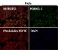 Anti-p53 (acetyl K370) TP53 Rabbit Monoclonal Antibody